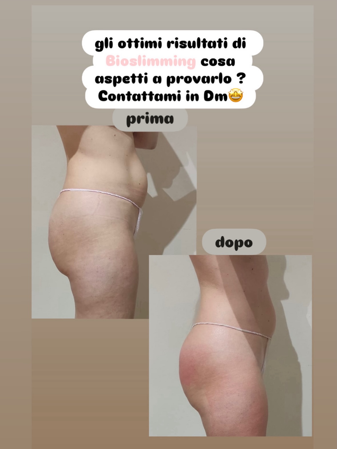 Risultato trattamento 3 – Vanità Estetic